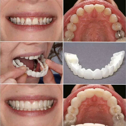 Cueen™ Smile Fit Flex Teeth Denture