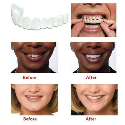 Cueen™ Smile Fit Flex Teeth Denture