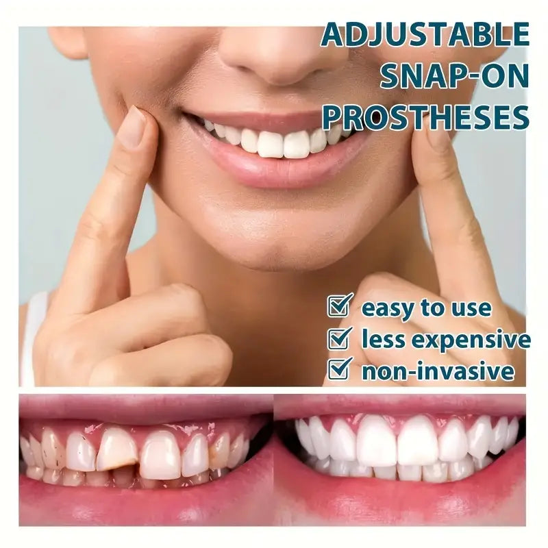 Cueen™ Smile Fit Flex Teeth Denture