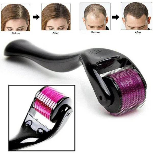 Cueen™ Derma Roller-For Hair Growth and Facial Skin Therapy